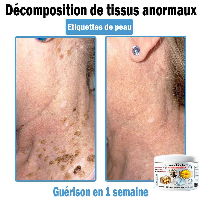 6 Pots✅Guérison complète & Consolidation thérapeutique